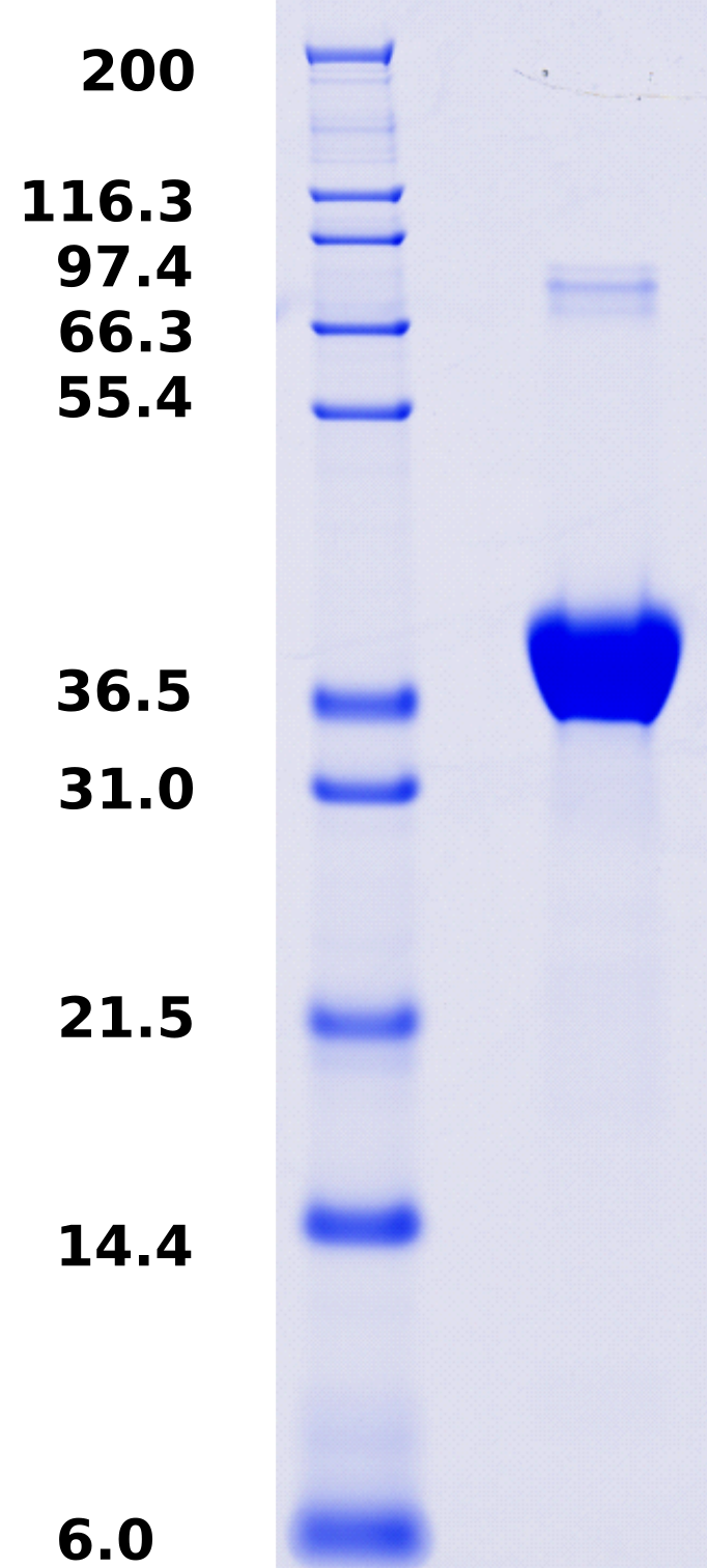 Proteros Product Image - µ-Calpain (rat) (29-356) 