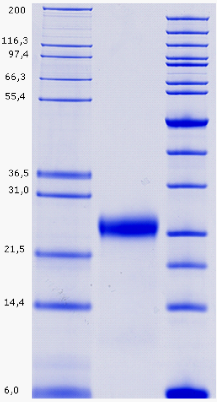 Proteros Product Image - ADAMTS-5 (262-480)