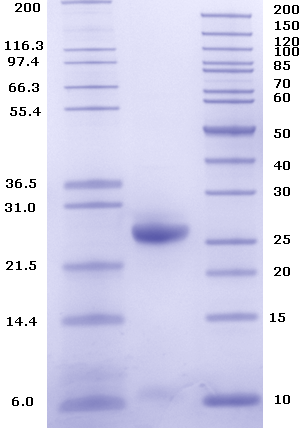 Proteros Product Image - ADAMTS-5 (262-483)