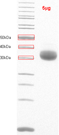 Proteros Product Image - ADAMTS-5 (human) (262-556) (E411Q)