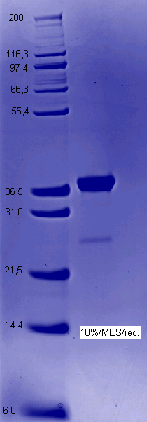 Proteros Product Image - ALK (human) (1069-1396) 