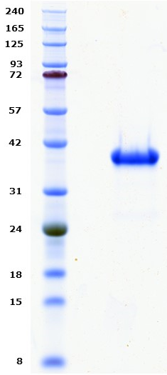 Proteros Product Image - ALK (human) (1069-1411) 