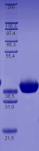 Proteros Product Image - ALK (human) (1081-1411) 