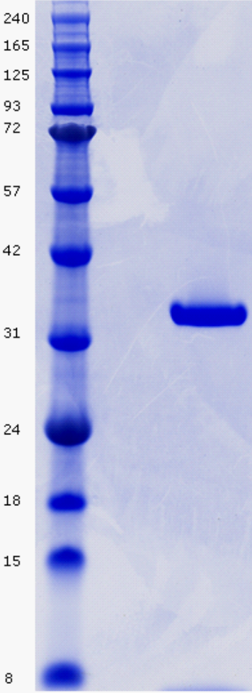 Proteros Product Image - Aurora B (Xenopus laevis) (78-356) (G96V) INCENP (Xenopus laevis) (790-847) complex 