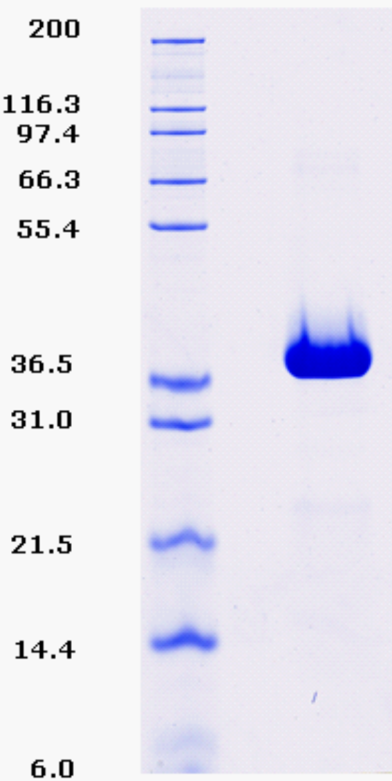 Proteros Product Image - BACE1 (human) (22-446) (R56T, R57T) 