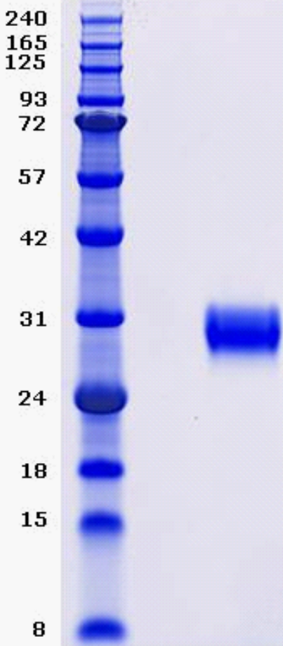 Proteros Product Image - BTK (human) (389-659) 