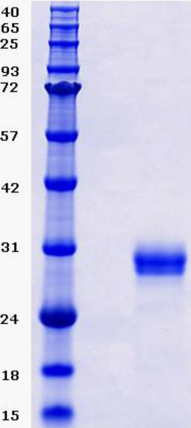 Proteros Product Image - BTK (human) (389-659) (T474A) 