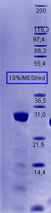 Proteros Product Image - Cathepsin L1 (human) (18-333) (T223A) 