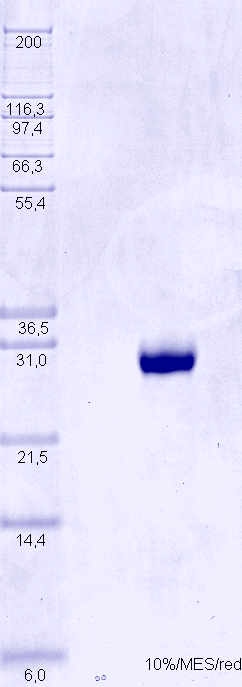 Proteros Product Image - Chymase (human) (22-247) (F135K) 