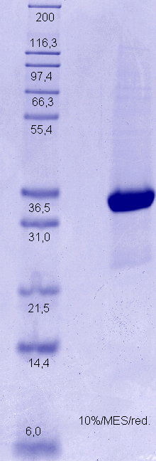 Proteros Product Image - c-Met (human) (1049-1360) (Y1194F, Y1234F, Y1235D) 