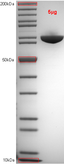 Proteros Product Image - Dengue Virus NS5, serotype 3 (Dv273-883) (strain Singapore/8120/1995)