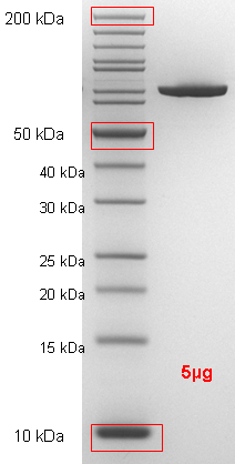 Proteros Product Image - Dengue Virus serotype 3 (strain Singapore/8120/1995) NS5 (273-900)