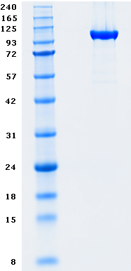 Proteros Product Image - DNMT1 (human) (646-1600) 