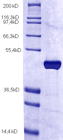 Proteros Product Image - Dot1L (human) (1-416) 