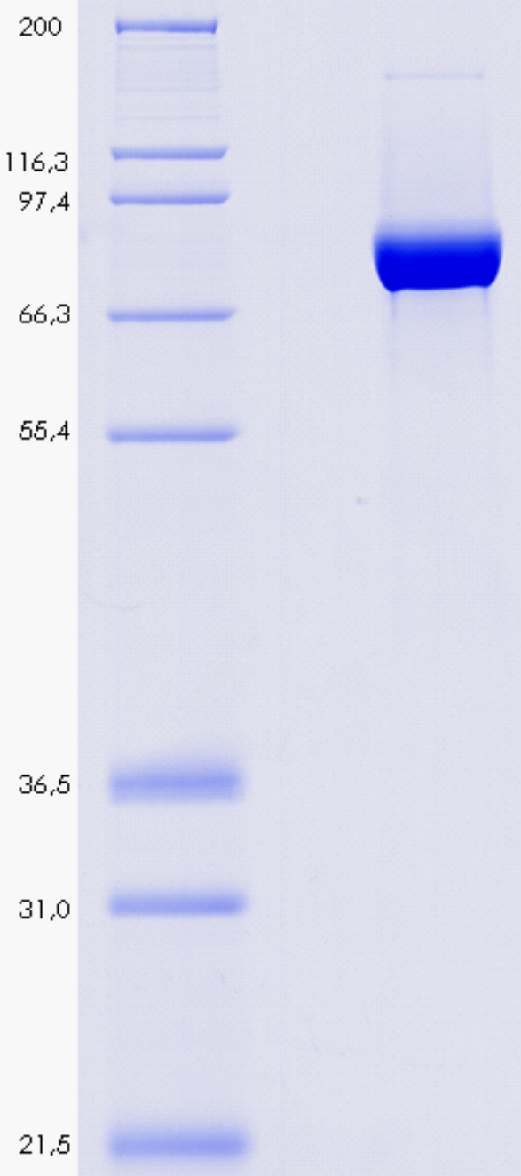 Proteros Product Image - DPP4 (human) (39-766) 