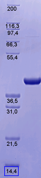 Proteros Product Image - eEF2Kinase (human) (2-341) 