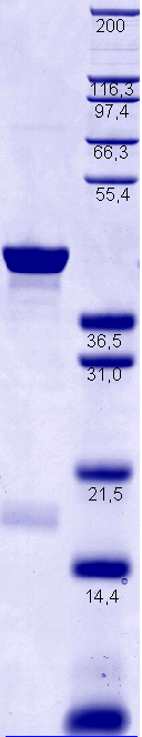 Proteros Product Image - eEF2Kinase (human) (2-354) 