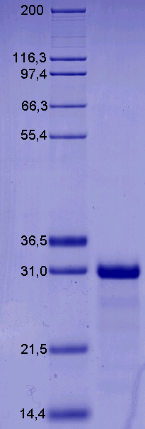 Proteros Product Image - eEF2Kinase (human) (82-341) 