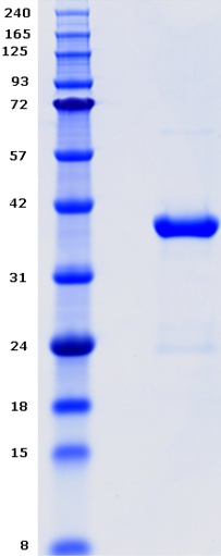 Proteros Product Image - EGFR kinase (human) (696-893) (T790M, L858R) 