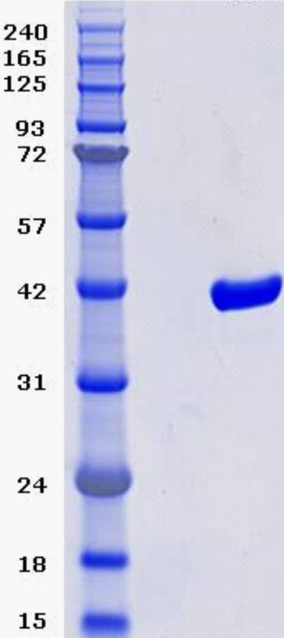 Proteros Product Image - ERK-2 (MAPK2) (human) (1-360) 