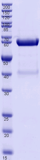 Proteros Product Image - FAAH (rat) (24-579) (human mutations L192F,F194Y,A377T,S435N,I491V,V495M) 