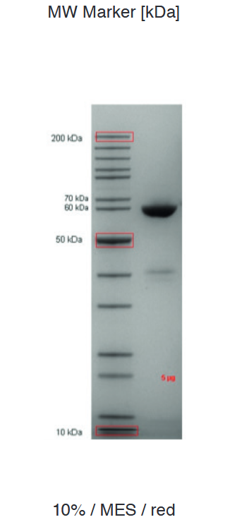 Proteros Product Image - FAAH (rat) (29-579) (human mutations L192F,F194Y,A377T,S435N,I491V,V495M) 