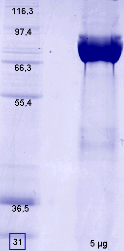 Proteros Product Image - FAPalpha (human) (38-760) 