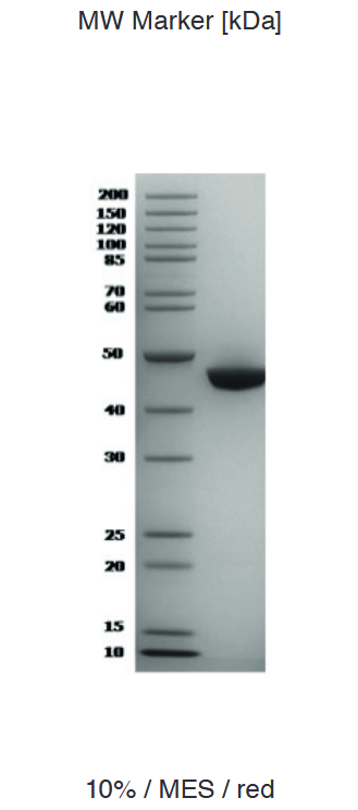 Proteros Product Image - FER kinase (human) (406-822) 