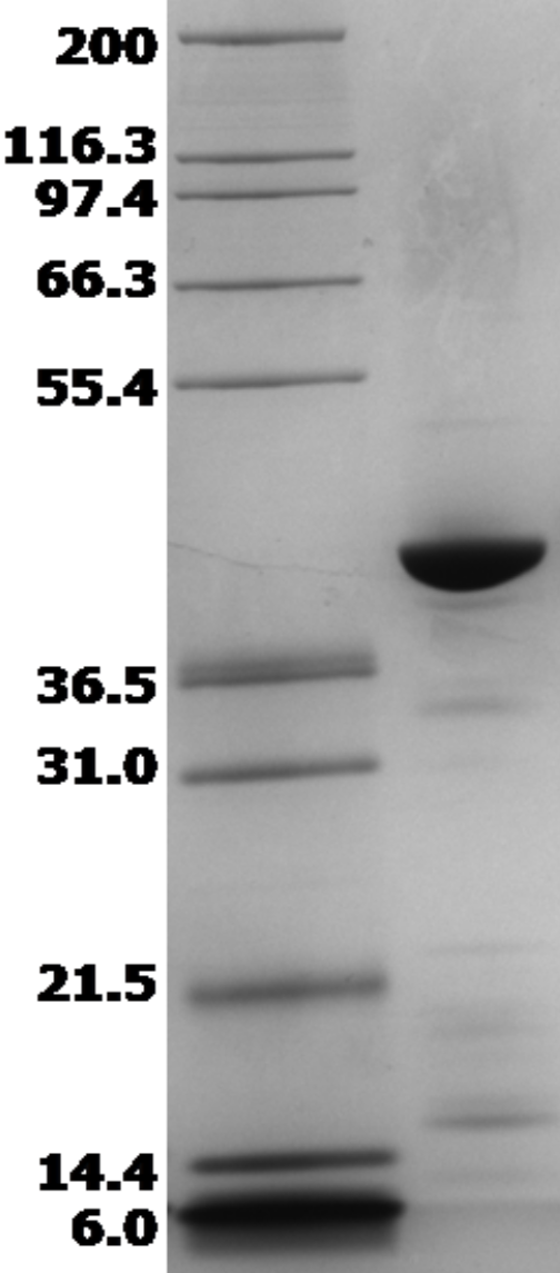 Proteros Product Image - FER kinase (human) (453-822) 