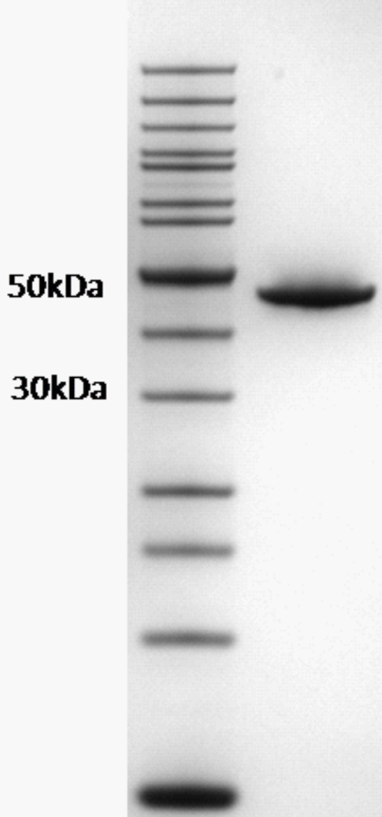 Proteros Product Image - FES kinase (human) (412-822) 