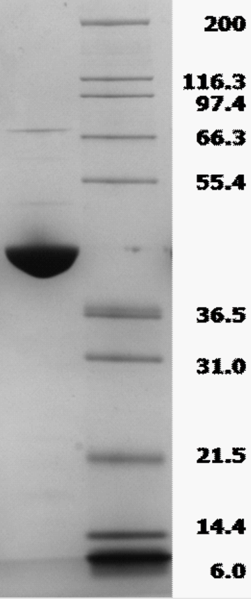 Proteros Product Image - FES kinase (human) (423-822) 
