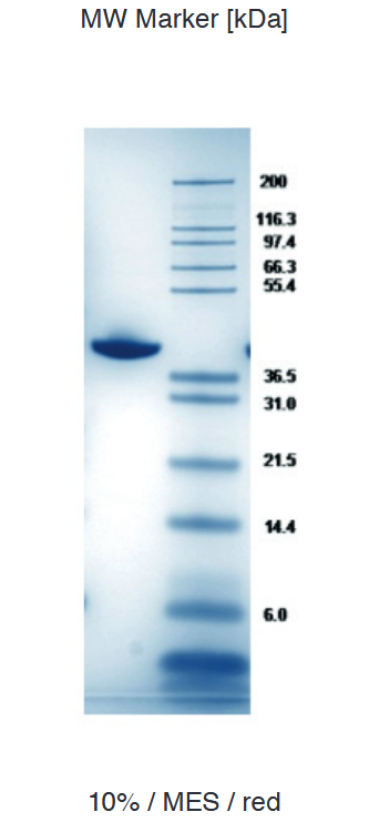 Proteros Product Image - FES kinase (human) (453-820) 
