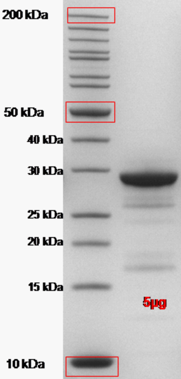 Proteros Product Image - FES kinase (human) (556-822) 