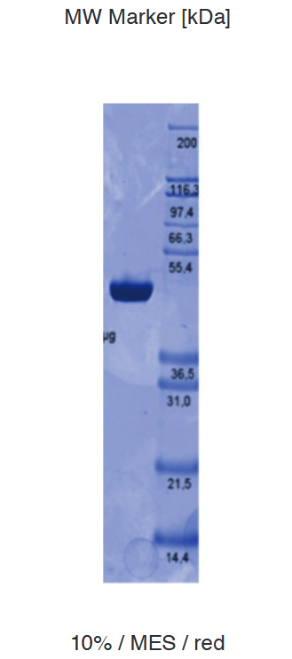 Proteros Product Image - GSK3 ß (human) (1-420) 