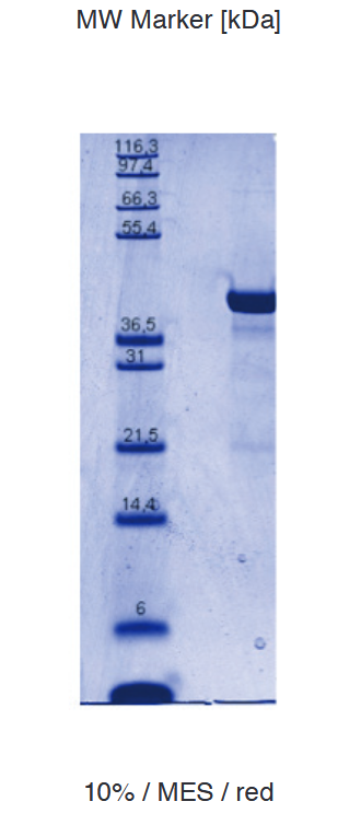 Proteros Product Image - GSK3 ß (human) (27-393) 