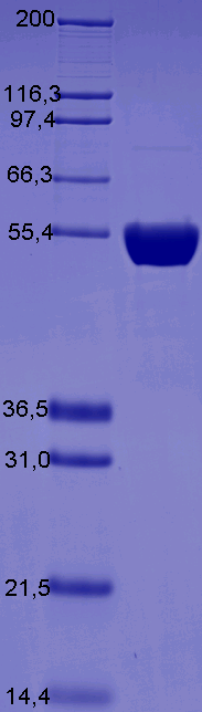Proteros Product Image - Gyrase Subunit A (Vibrio cholerae serotype O1) (2-522) 