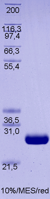 Proteros Product Image - Gyrase Subunit B (Vibrio cholerae serotype O1) (2-220) 