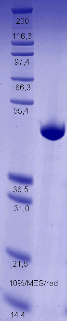 Proteros Product Image - Gyrase Subunit B (Vibrio cholerae serotype O1) (2-396) 