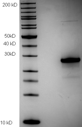 Proteros Product Image - HCV genotyp 1b (isolate Con1) NS5A (251-448) 