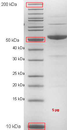 Proteros Product Image - HCV genotyp 1b (isolate Con1) NS5A (33-448) 