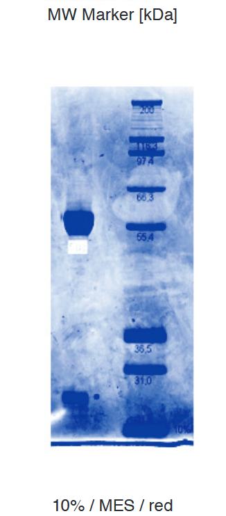 Proteros Product Image - HCV NS5B (1-536).docx