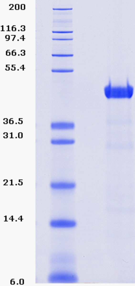 Proteros Product Image - HDAC2 (human) (1-488)-HIS (digested with Trypsin) 