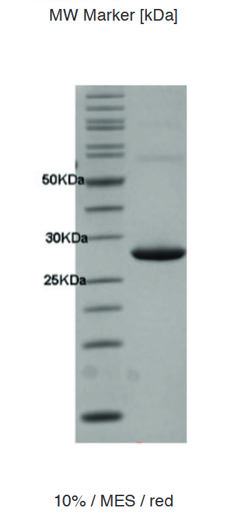 Proteros Product Image - HSP90 (human) (1-236) 