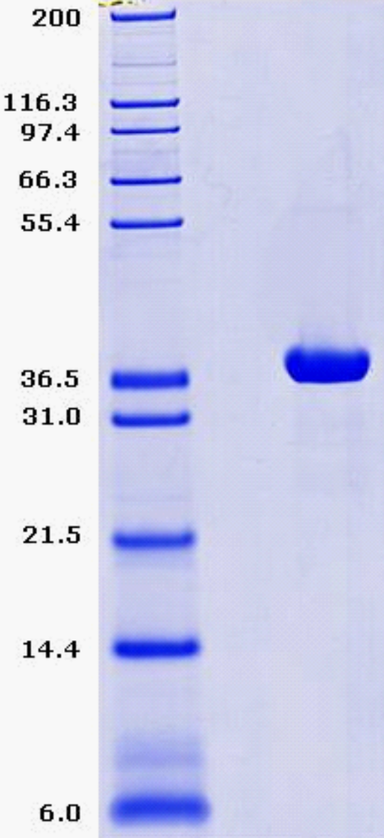 Proteros Product Image - IGF1RK (human) (974-1294) (C1008S) 