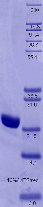 Proteros Product Image - IL-6 (human) (28-212) 