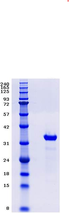 Proteros Product Image - Insulin Receptor (human) (978-1283) (C981-1008S) 