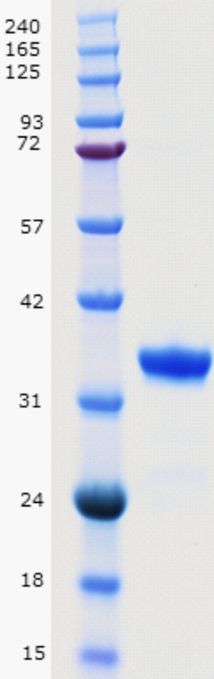 Proteros Product Image - JAK1 (human) (854-1154) 