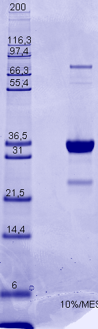 Proteros Product Image - JAK3 (human) (810-1115) 