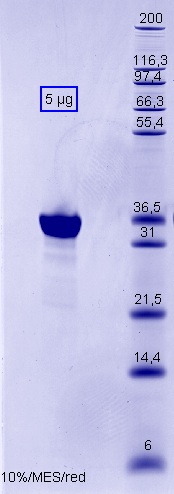 Proteros Product Image - JAK3 (human) (810-1124) 