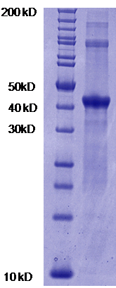 Proteros Product Image - JMJD2A (human) (1-359) 